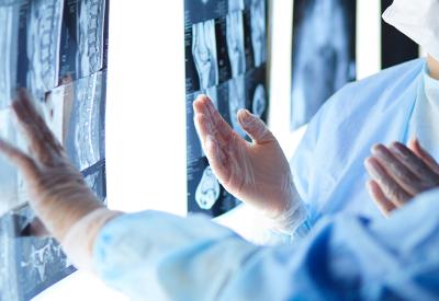Doctors looking at X-ray